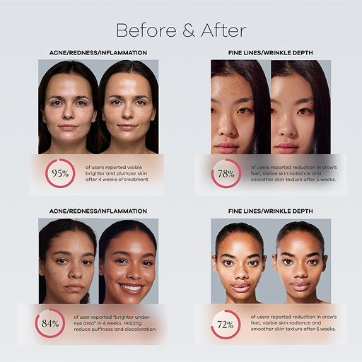 Advanced-Spectrum Mask