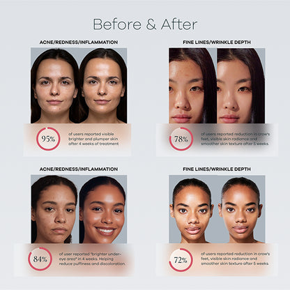 Advanced-Spectrum Mask